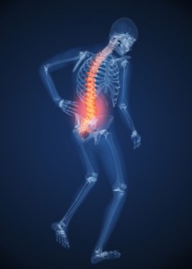 Chronic lesion of lumbar muscles